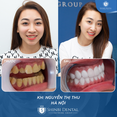 Khách hàng Nguyễn Thị Thu